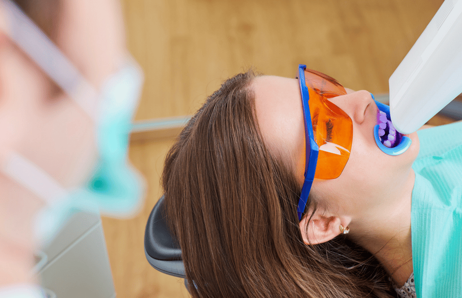 Professional tooth whitening