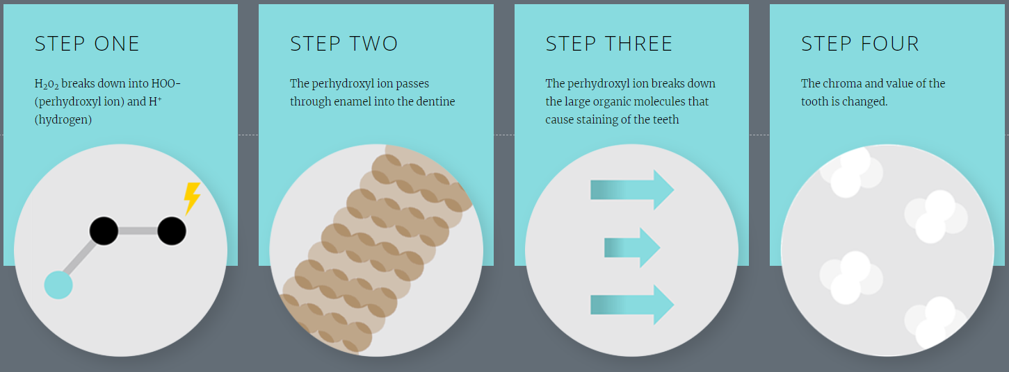 Four Steps to Whiter Teeth