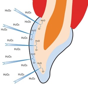 Opalescence Hydrogen Peroxide breakdown Image