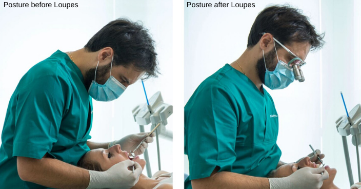 Posture before Loupes