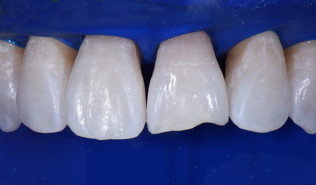 Bioclear case study image