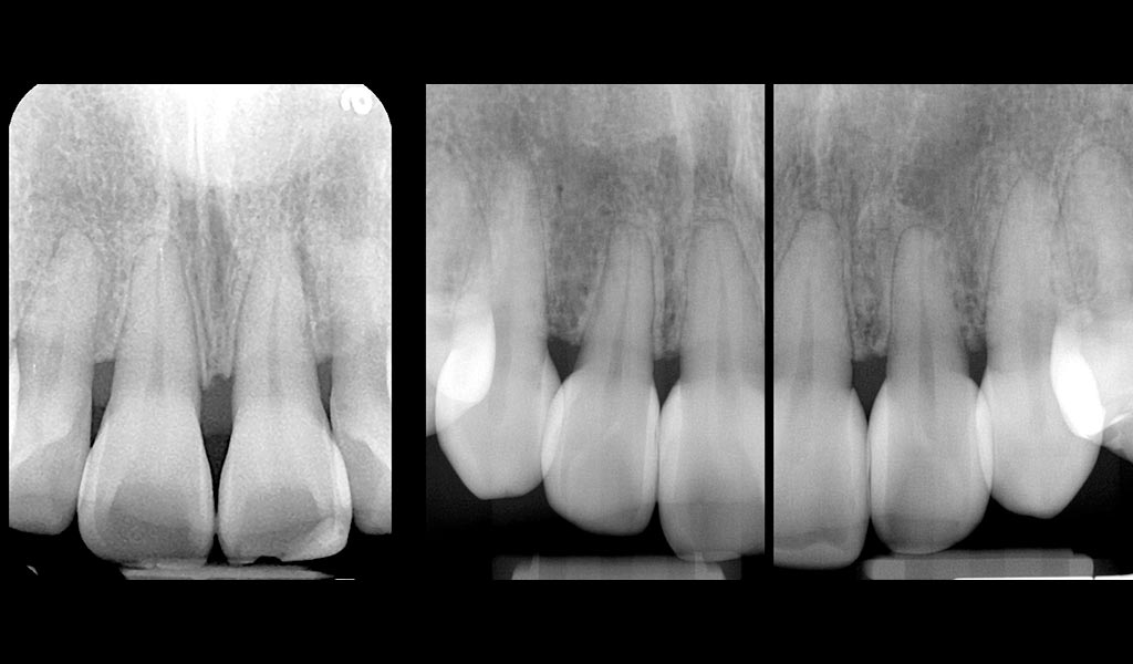 Bioclear case study X Ray image