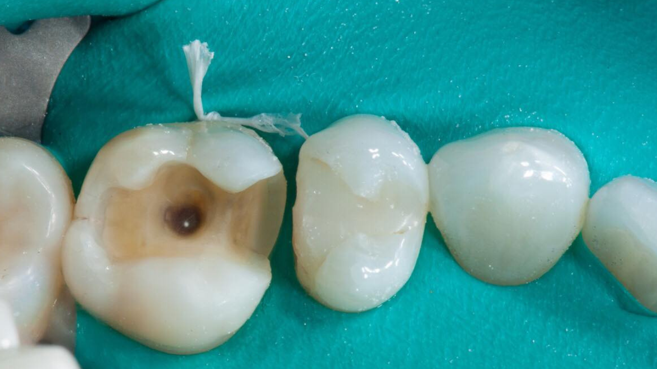 5 Essential Uses For The AquaCare Optident